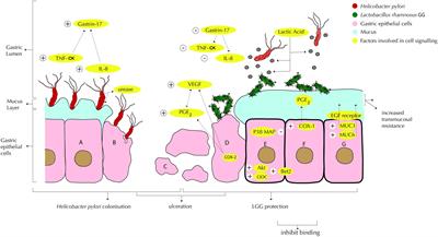 The Probiotic Lactobacillus rhamnosus for Alleviation of Helicobacter pylori-Associated Gastric Pathology in East Africa